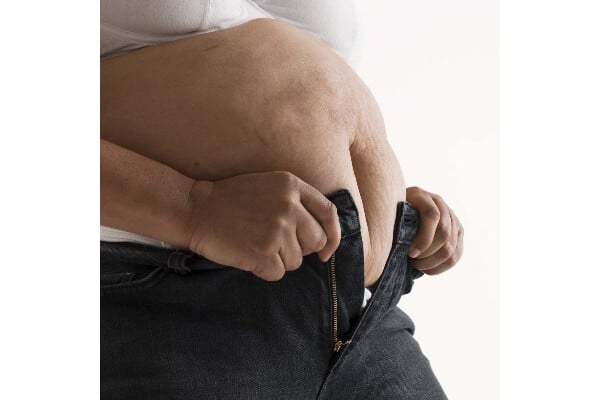 Obesidade: encare o excesso de peso