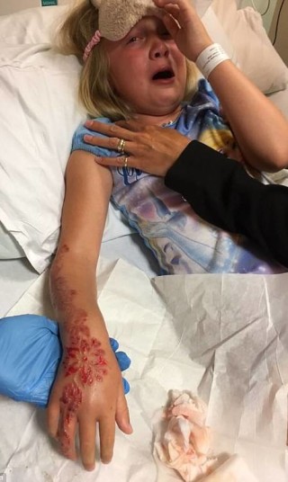 Criança teve reação química causada pela tinta da tatuagem