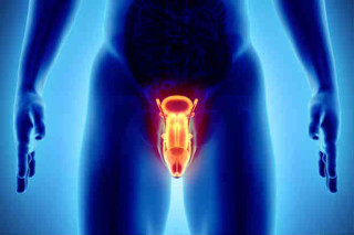 Hiperplasia Benigna da Próstata pode causar ejaculação retrógrada