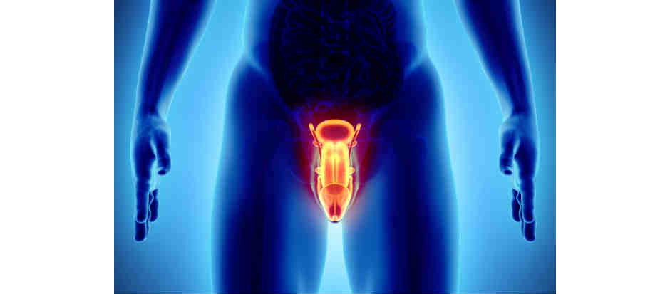 Hiperplasia Benigna da Próstata pode causar ejaculação retrógrada