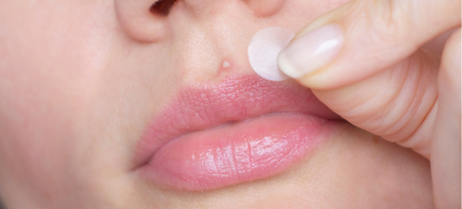 Mulher aplicando adesivo na espinha acima dos lábios