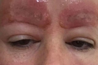 Tatuagem de sobrancelhas dá errado e mulher fica traumatizada - foto: Divulgação/Facebook