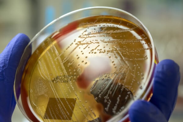 Recorte de foto de microbiologista segurando uma placa com bactéria Streptococcus pyogenes