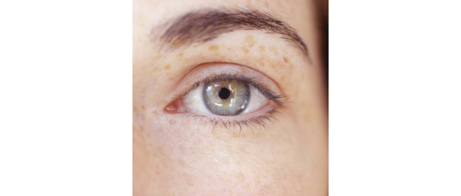 Conjuntivite é uma doença contagiosa. Veja como o problema afeta o seu olho. 