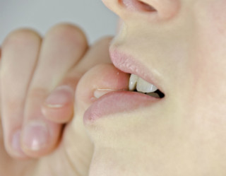 Os 10 piores hábitos que estragam os seus dentes