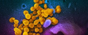 Unicamp e USP criam novo teste para diagnosticar coronavírus - Créditos: Divulgação/Fapesp