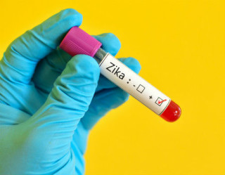 Exame de Zika vírus: saiba mais sobre o PCR