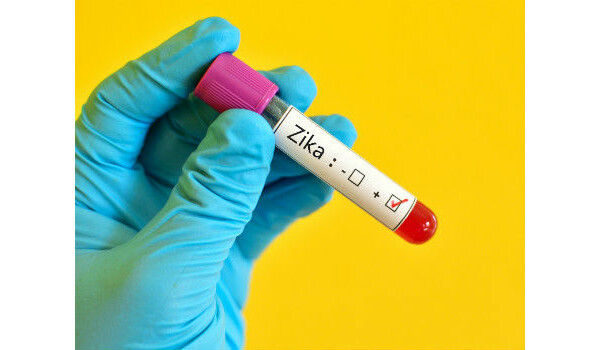 Exame de Zika vírus: saiba mais sobre o PCR