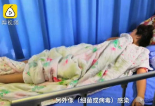Tang, uma das vítimas, foi internada dois dias após completar o desafio - Foto: China Press