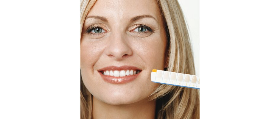 Clareamento dental deixa os dentes sensíveis? - Dúvidas de saúde bucal