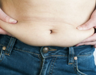 Flacidez abdominal normalmente ocorre após gestação e grande perda de peso. 