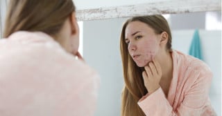 10 hábitos de cuidados da pele que podem PIORAR a acne