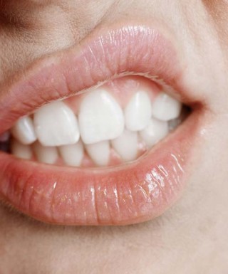 Mulher mostrando os dentes da boca