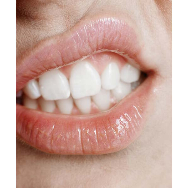 Mulher mostrando os dentes da boca