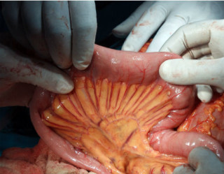 Cientista classifica um novo órgão no corpo humano, o mesentério