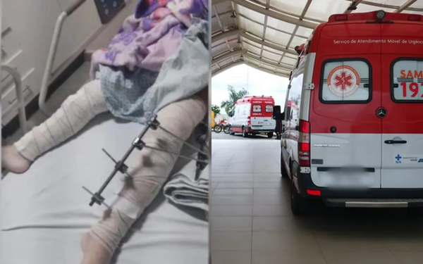 à esquerda, imagem aproximada de uma criança deitada em uma maca com as pernas enfaixadas e pinos. à direita, uma ambulância estacionada no Hospital de Trauma de Campina Grande