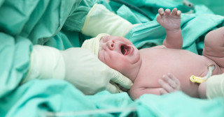 Bebês que nascem com intervenção têm maior risco de doenças na infância Foto: Shutterstock
