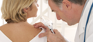 Médico dermatologista examina pinta nas costas de uma mulher branca e de cabelos loiros com um dermatoscópio