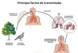 Como ocorre a transmissão da Doença do Pombo - Imagem: Ministério da Saúde
