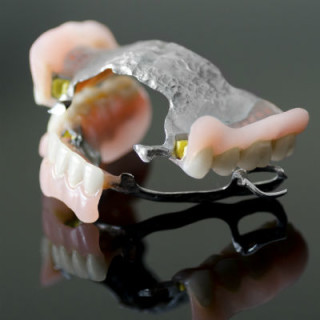 Protese dentária parcia