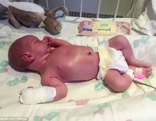 Bebê de 9 dias contrai meningite após ser beijado por adulto 