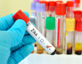 Vacina do Zika Vírus deve ir a testes em humanos em dois meses