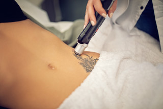 Médico passando laser em cima de tatuagem de cliente