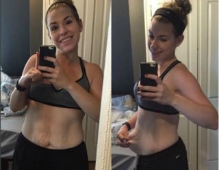 Mulher perde 40 kg e mostra realidade da mudança do corpo