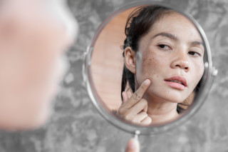 Mulher analisando manchas no rosto pelo espelho