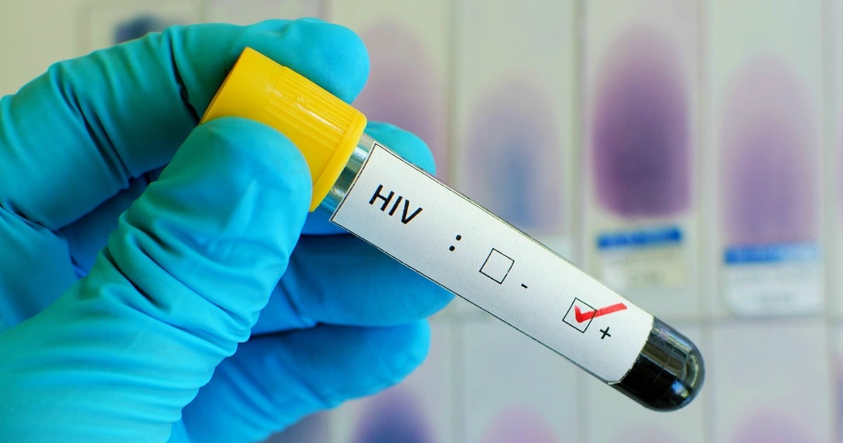 Sintomas de HIV: primeiros sinais e quando fazer o teste