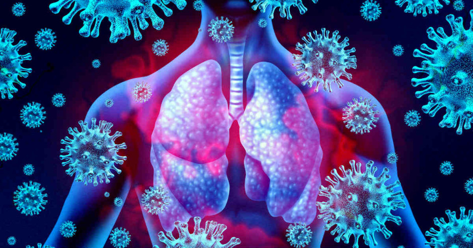 Coronavírus pode causar danos permanentes no pulmão: entenda - Créditos: Lightspring/Shutterstock