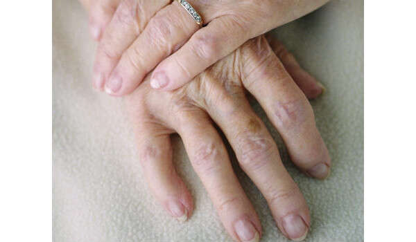 O tratamento para Parkinson apresenta resultados imediatos