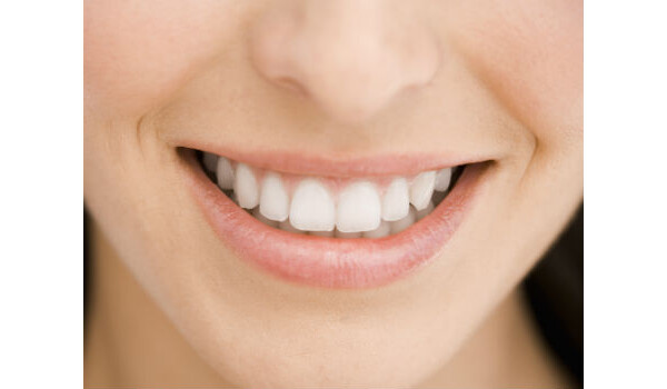 Facetas deixam os dentes mais bonitos, mas devem ser aplicadas depois dos dentes estarem alinhados