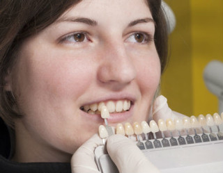 Dentista olhando a cor do dente de uma mulher