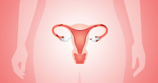 Endometriose
