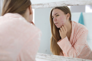 5 sinais que a pele do rosto dá sobre sua saúde