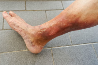 Foto: Reprodução/Shutterstock