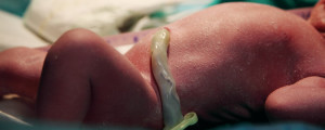 bebê recém-nascido com o cordão umbilical