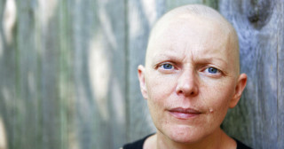 Queda de cabelo devido a quimioterapia