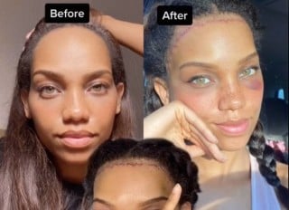 Antes e depois modelo Camilla Coleman Brook. Foto: Reprodução | TikTok