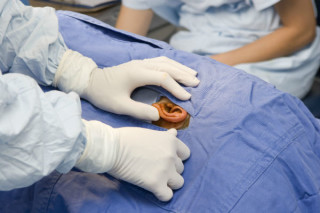 A otoplastia deve ser realizada em hospital por profissionais especializados - foto: Getty Images