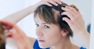 Conheça os tipos de alopecia que podem causar queda de cabelo