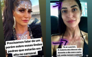 No carnaval de 2019, a atriz  Maria Joana compartilhou imagens das marcas causadas por adereços de carnaval