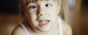 Na imagem, uma criança com estrabismo mostra os dentes