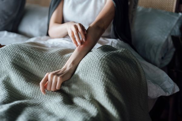 Mulher deitada na cama coçando o braço; a urticária é um dos sintomas de alergia a medicamentos