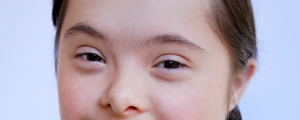 Close up do olhar de uma garotinha com síndrome de Down