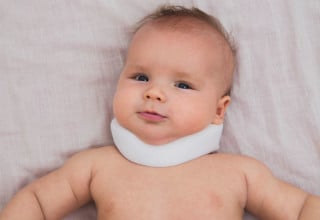 Torcicolo congênito costuma ser mais comuns em bebês - Foto: Shutterstock