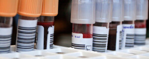 tubos de amostra de sangue em laboratório