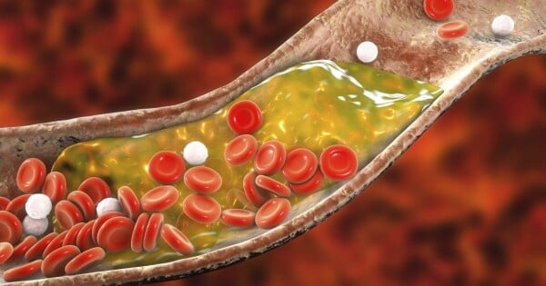 Ilustração de células do sangue e colesterol em uma artéria
