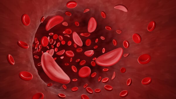 Ilustração gráfica das células sanguíneas com anemia